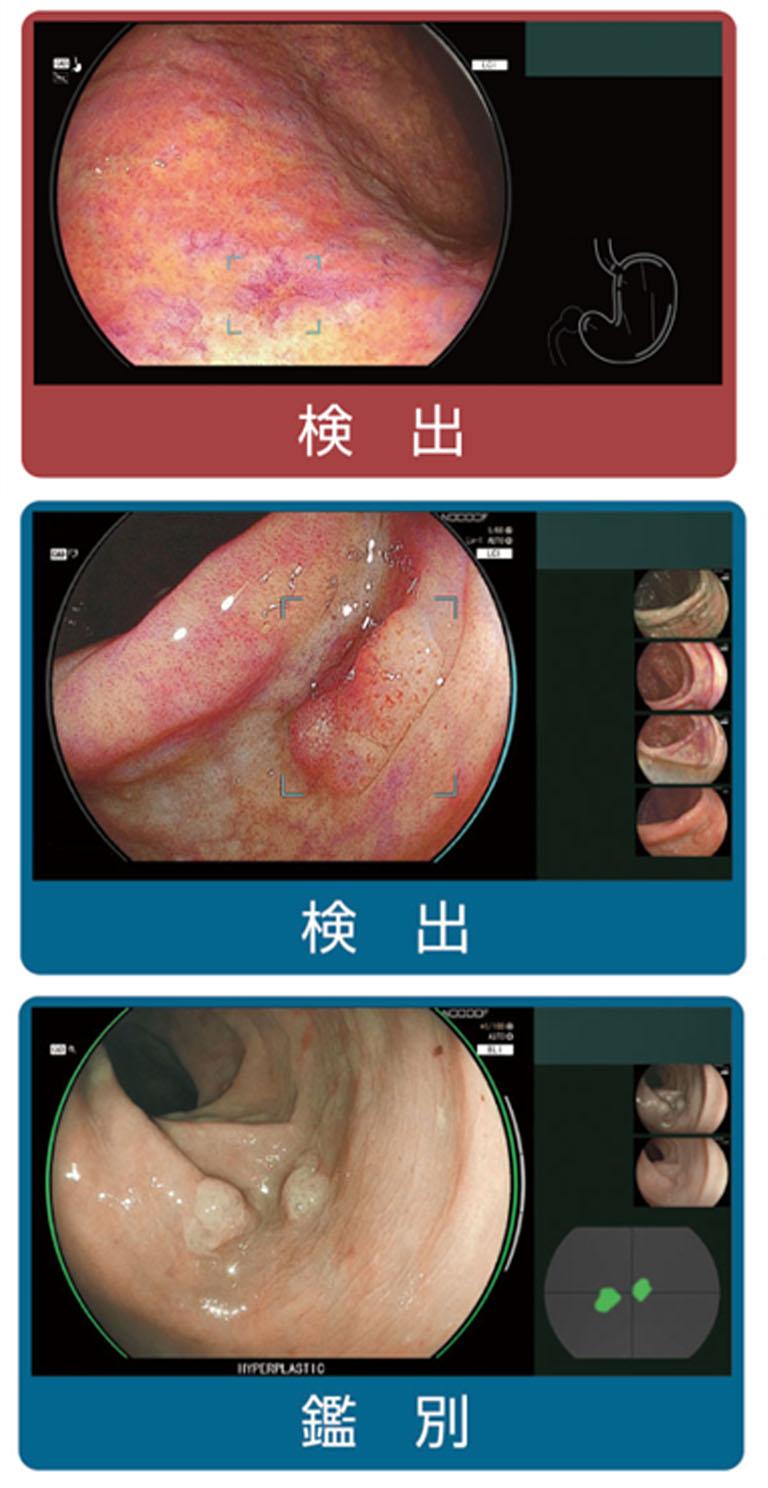 検出・鑑別