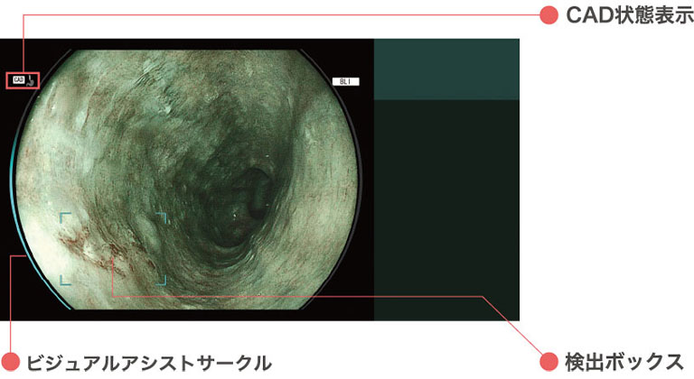 検出支援モード