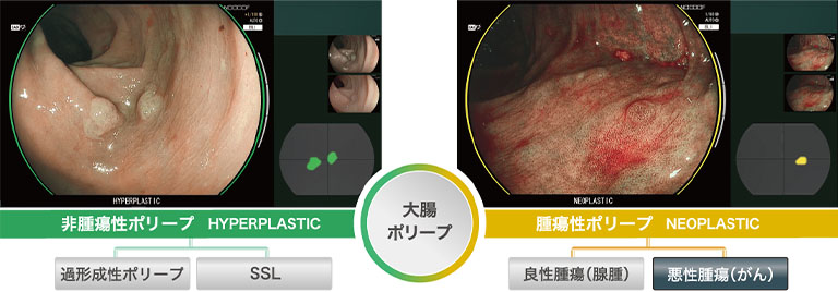 鑑別支援モード